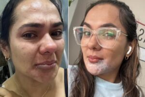 viral-empanada-caliente-redes