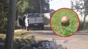 HALLAZGO RESTOS HUMANOS ABASTO