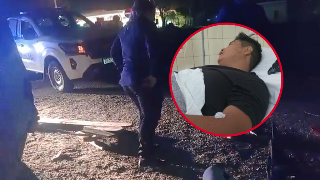 CHOQUE-RUTA-2-MOTOCICLISTA-HERIDO-CONDUCTOR-FUGA